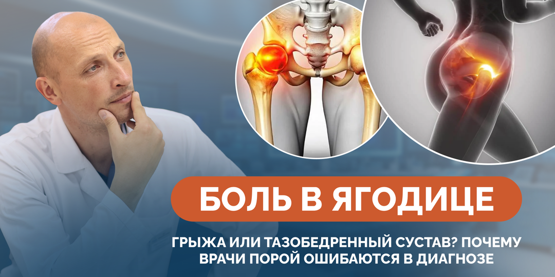 Боль в ягодице: грыжа или тазобедренный сустав? Почему врачи порой ошибаются в диагнозе