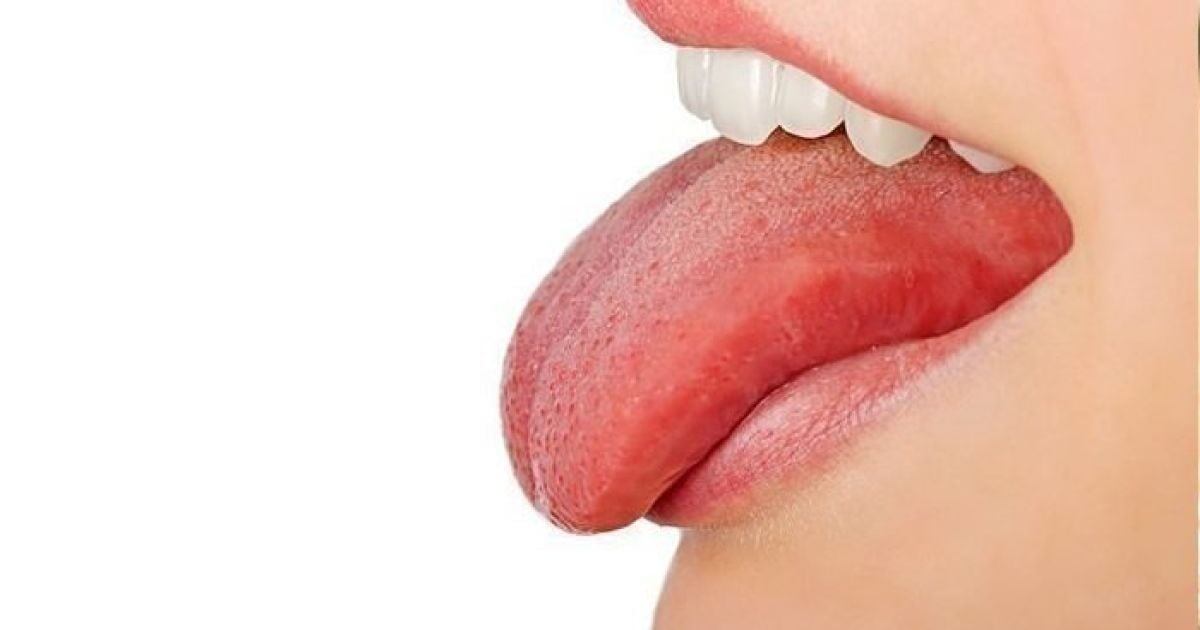 Как диагностировать различные заболевания по своему языку?