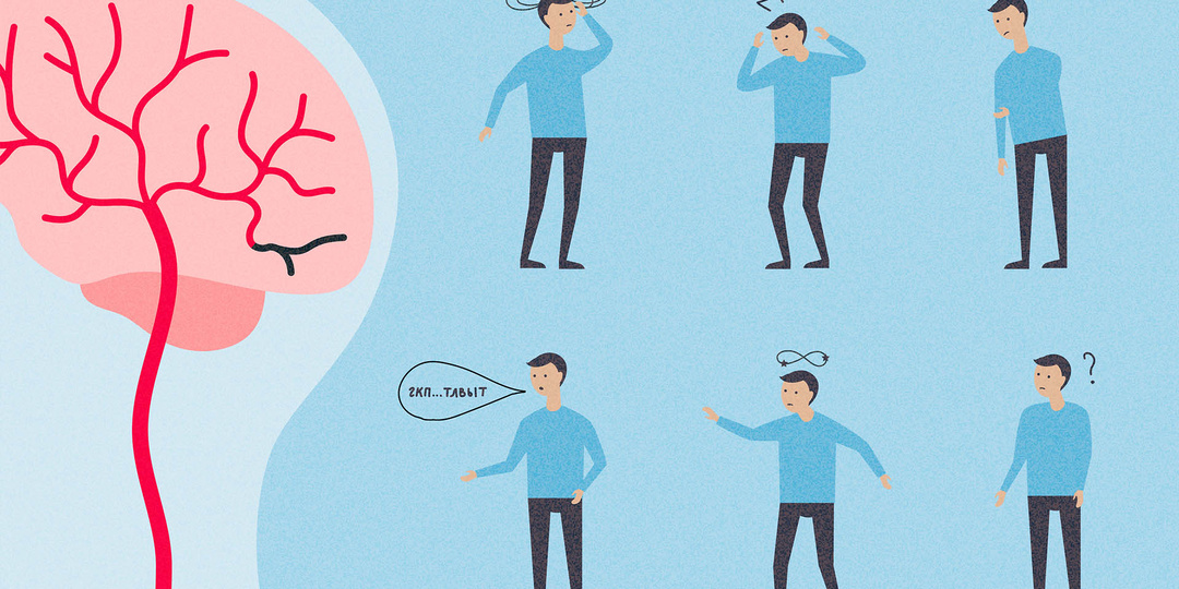 Что такое «немые инсульты» и чем они опасны?