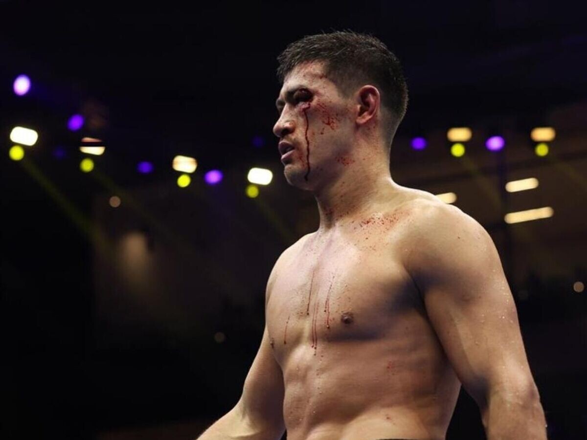    Дмитрий Бивол | © Соцсети боксера