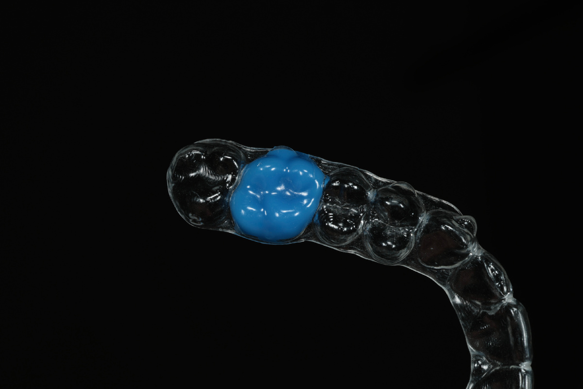 Материал в капе