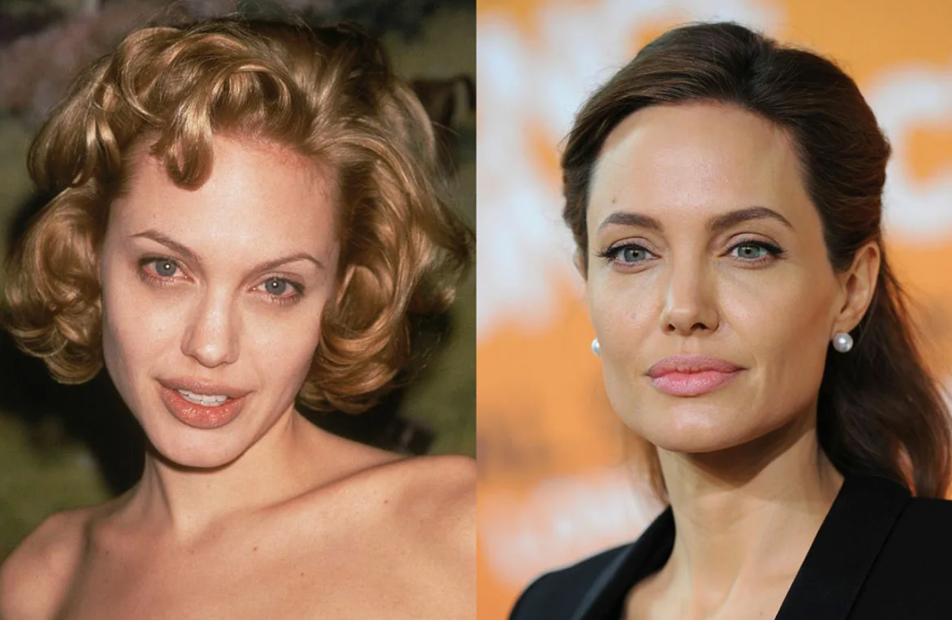 Анджелина Джоли: до и после пластики