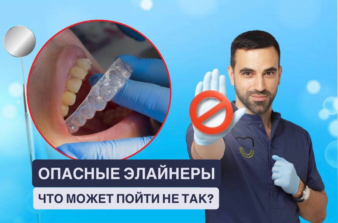 элайнеры / ортодонт / лечениезубов / красиваяулыбка