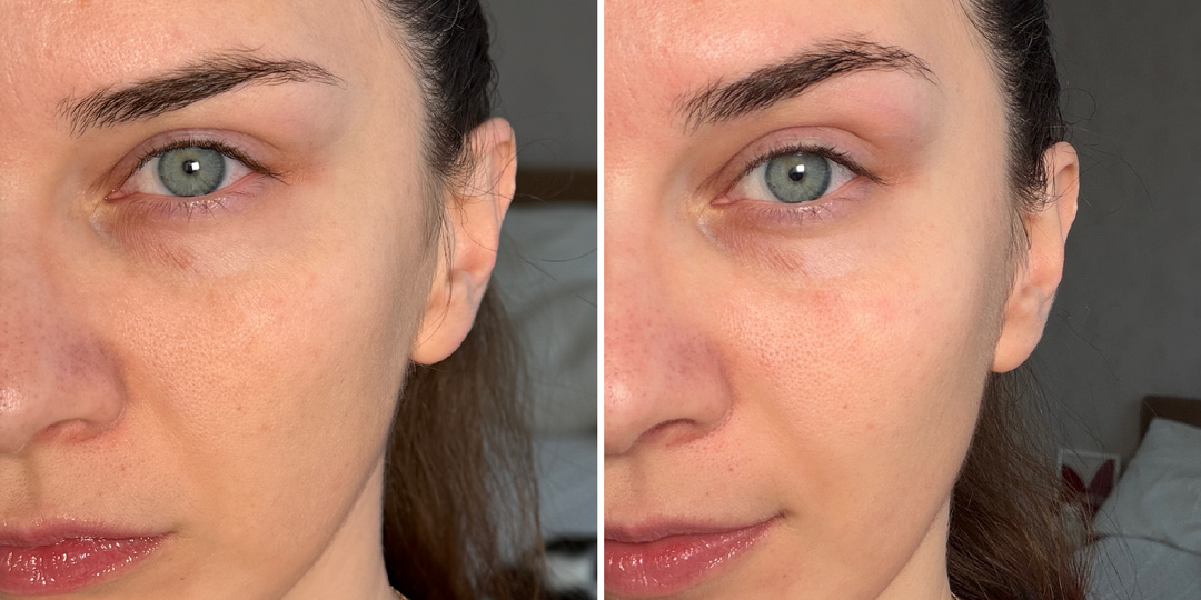 Вливаемся в рабочие будни настоящей красавицей: чем освежить лицо и убрать «новогоднюю отечность»