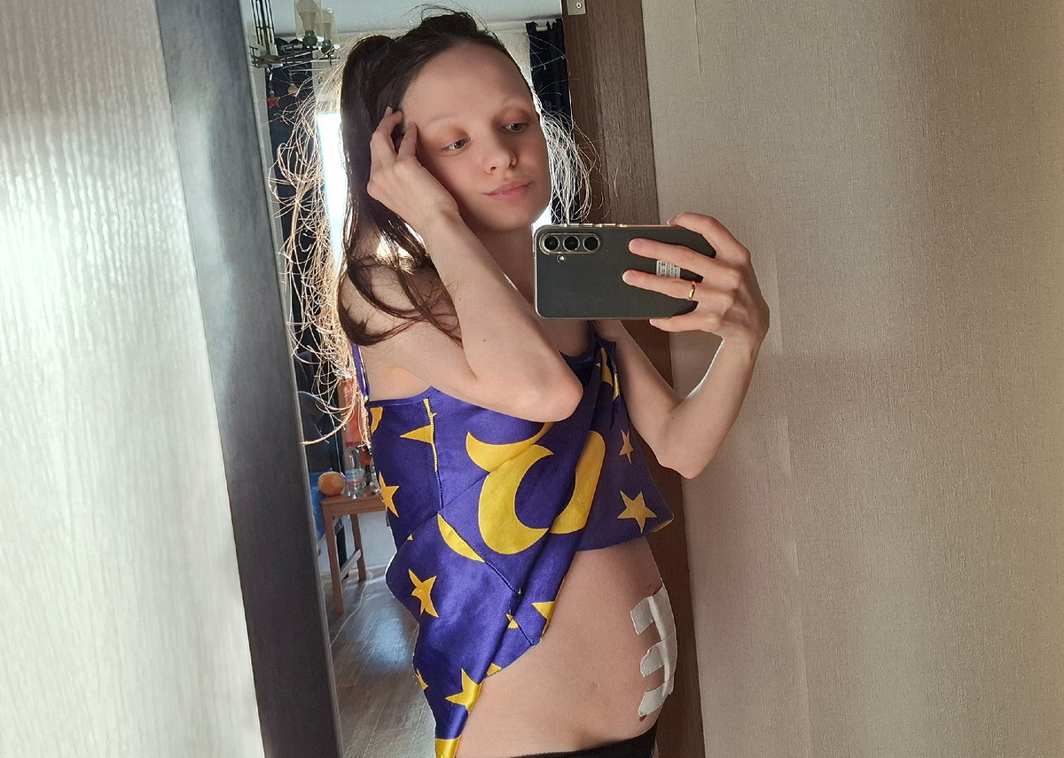 После третьего лапароцентеза