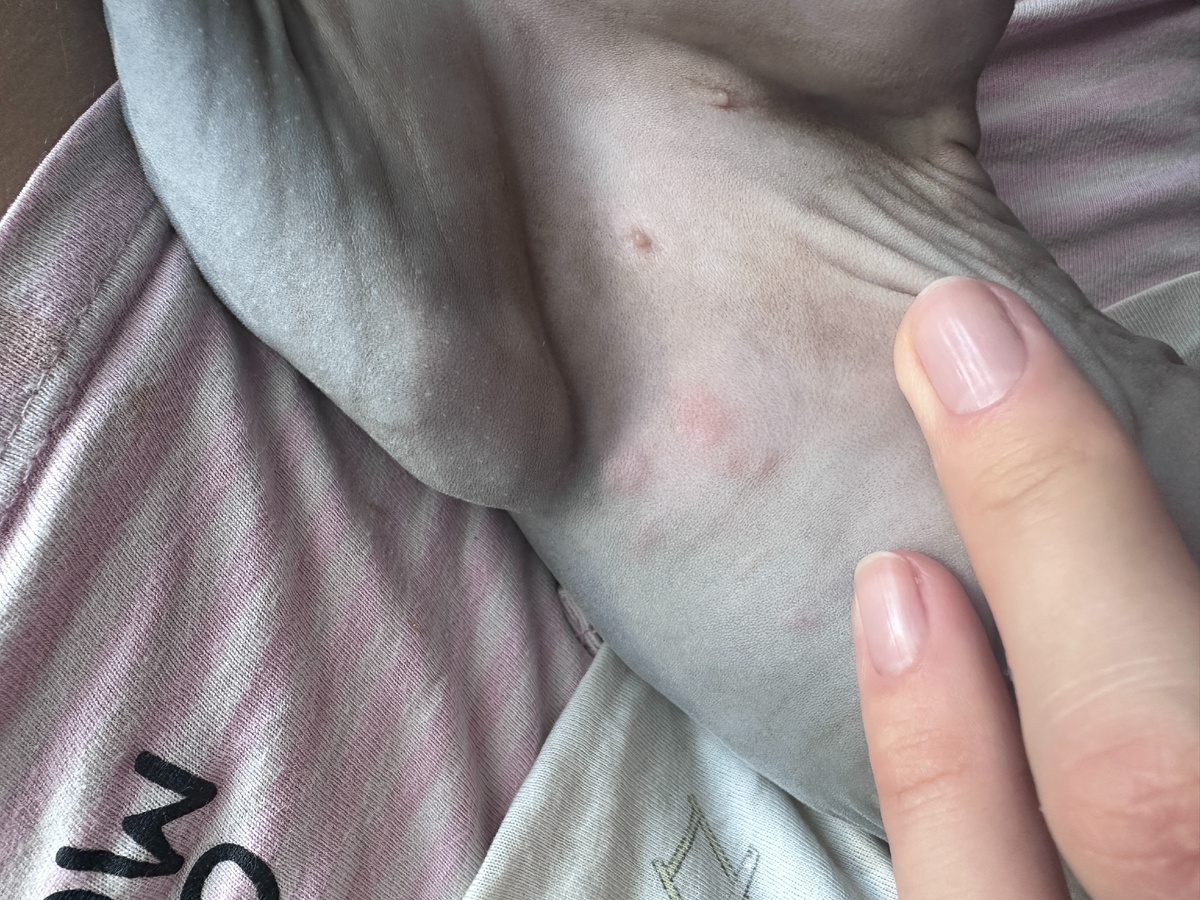 Аллергия у Эль в 3-4 месяца