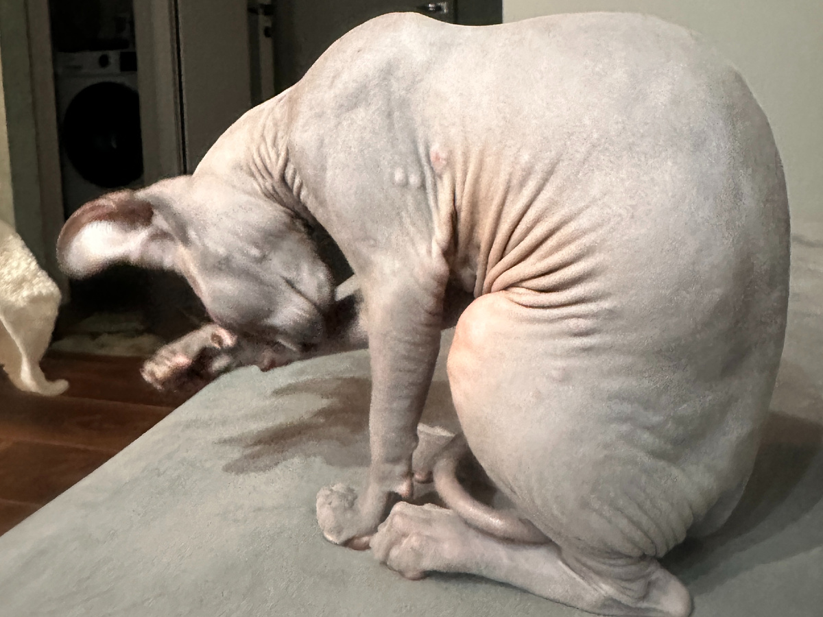 Эль 4 месяца. Все тело усыпано папулами. Реакцию давало буквально всё, от еды до новой одежды