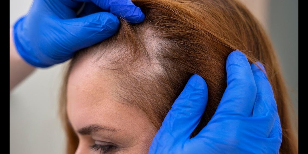 Ломкие волосы и выпадение: проблема может быть не в коже головы