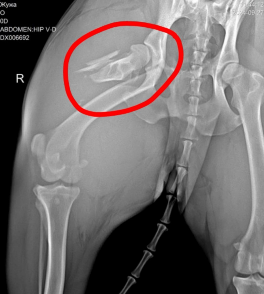 Рентгеновский снимок моего правого бедра