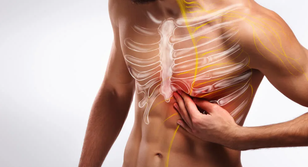 Межреберная невралгия: когда "сердце колет", а сердце тут ни при чем