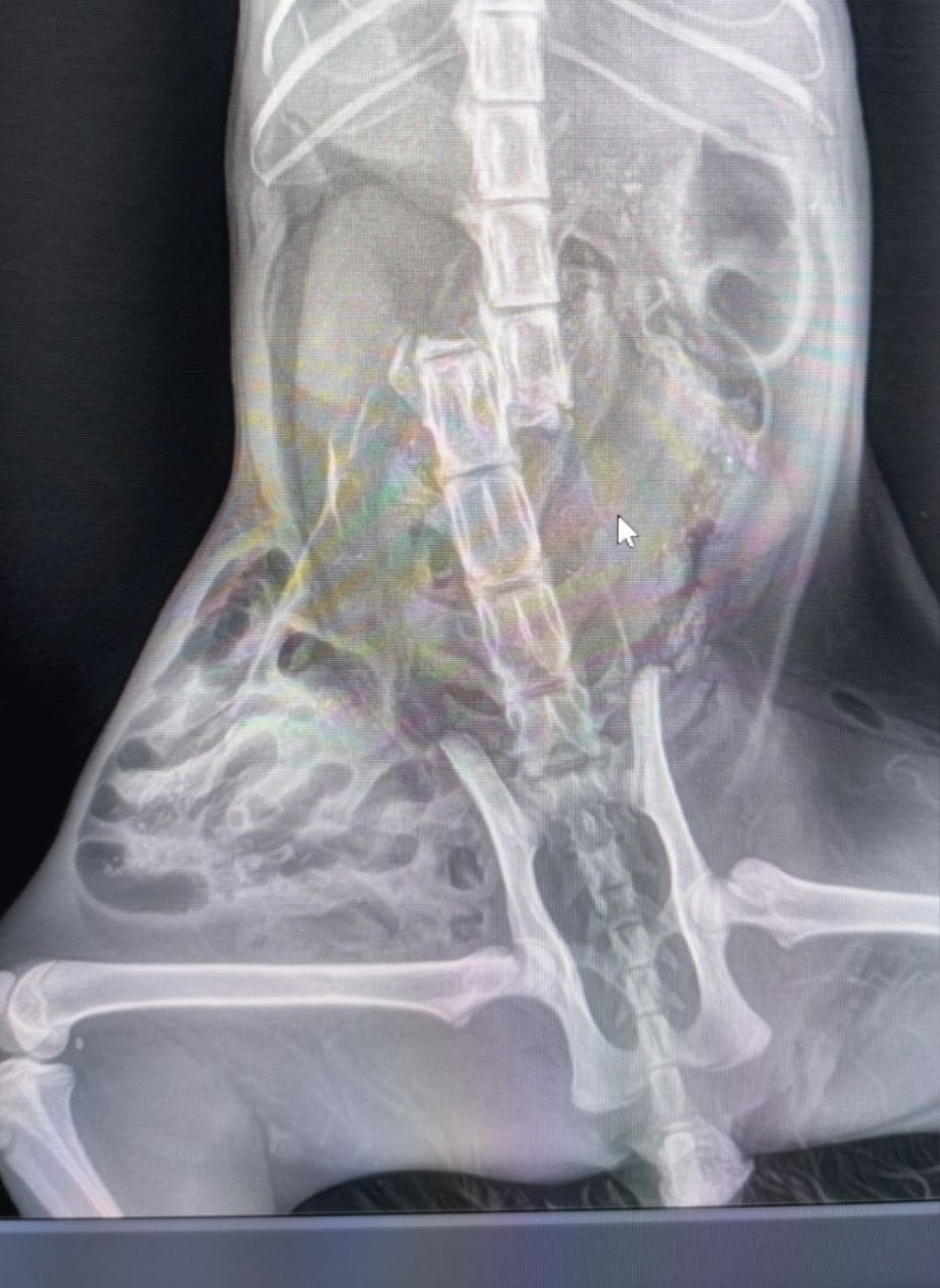 Неутишительный рентген. Фото из архива автора