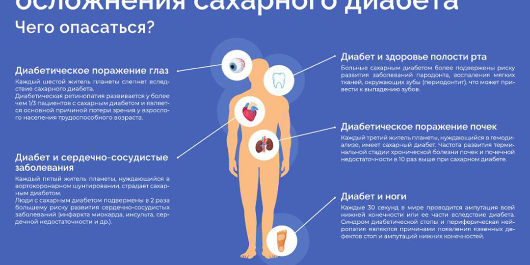 Сахарный диабет: как услышать тихие сигналы тела и не лишиться ног