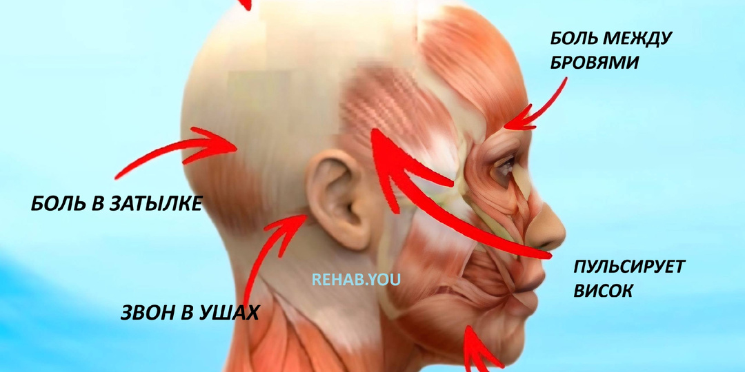 Карта головной боли: как по месту боли понять возможную причину