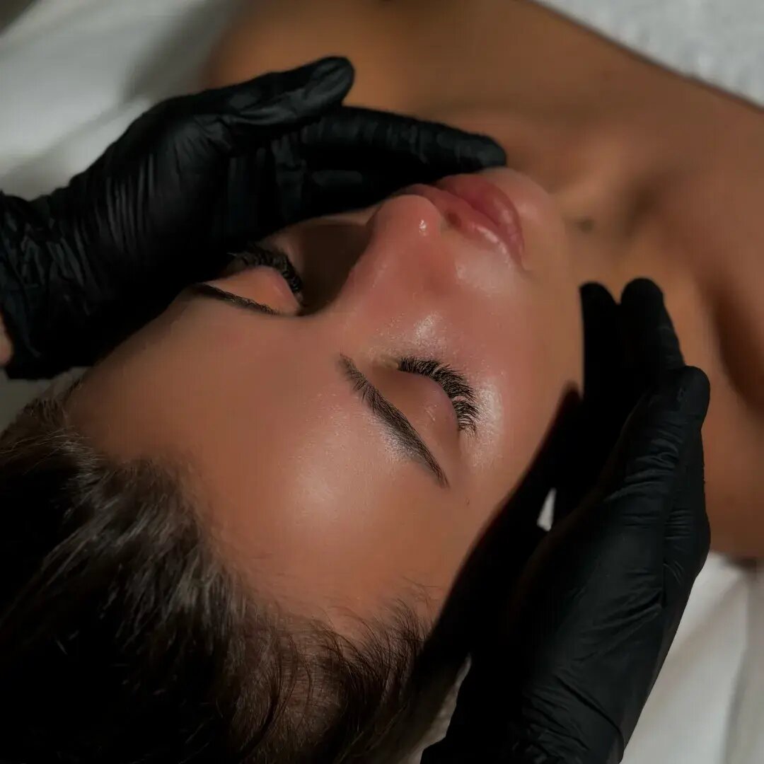 Фотоомоложение в клинике косметологии Uniqderm