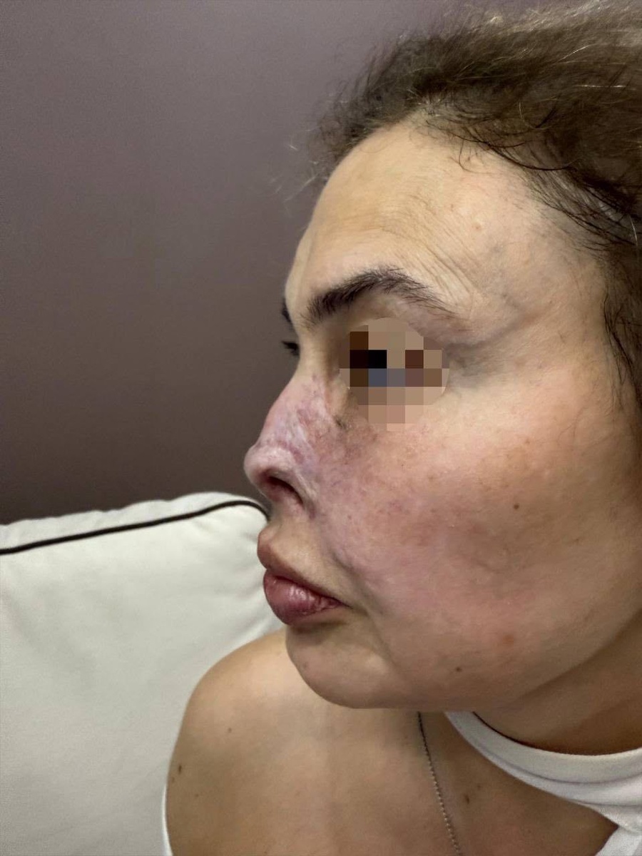 Фото пациента ДО операции