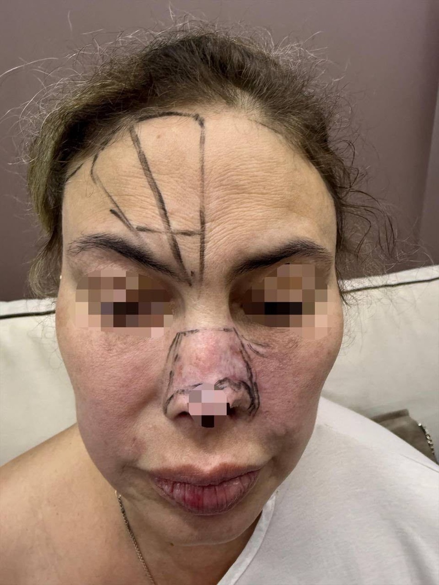 Фото пациента ДО операции 