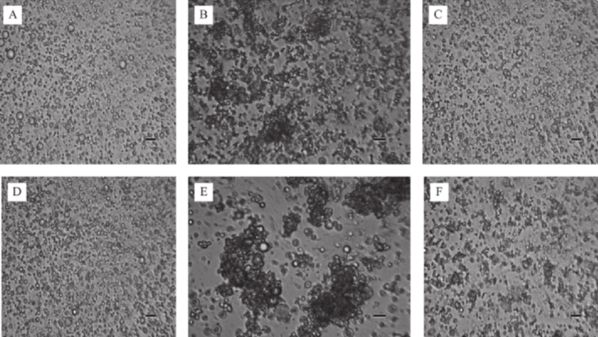 Жировые шарики под микроскопом — научное фото эмульсии, капли жира в молоке
