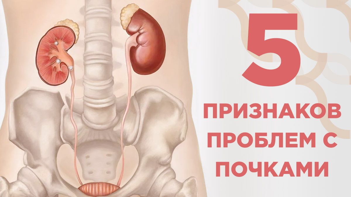 5 опасных признаков заболеваний почек