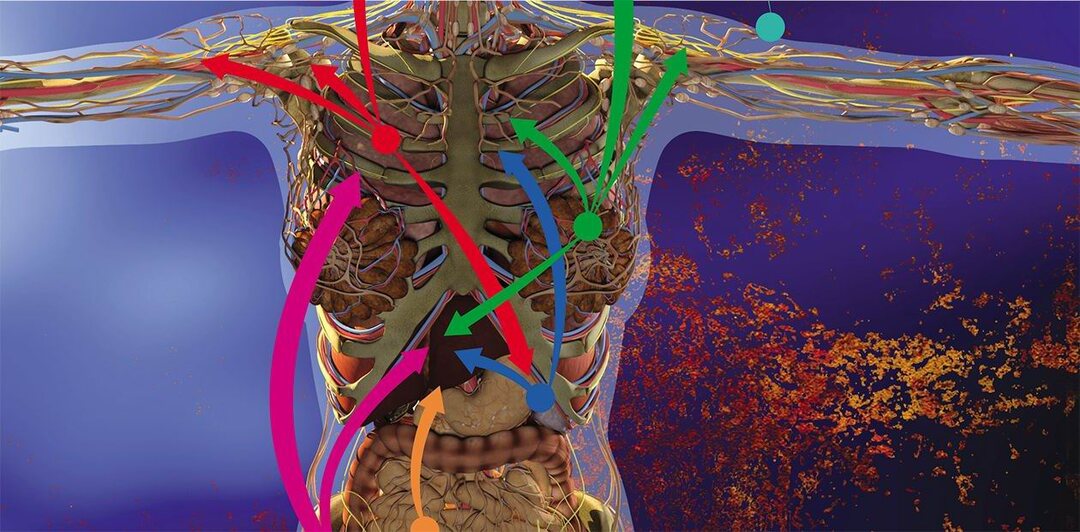 Что на самом деле означают метастазы при раке и почему это не конец пути
