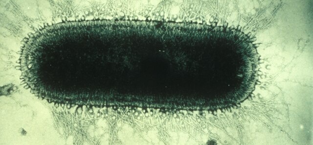    Electron microscope image of rabies virus Василий Соколов