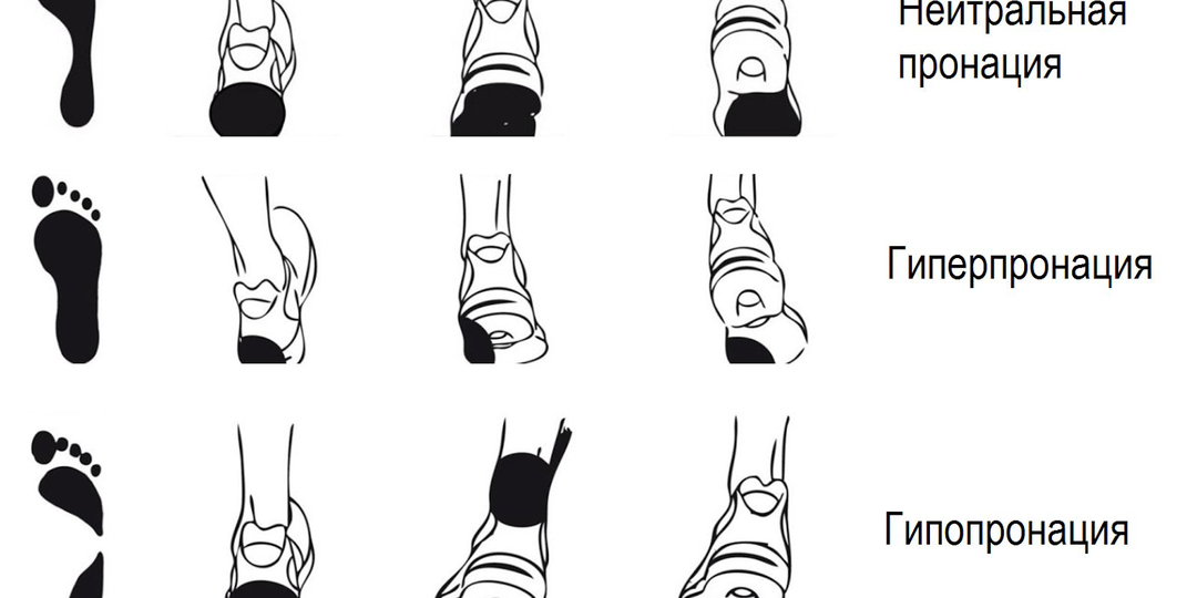 Про стопы бегунов. Пронация, завал стопы и почему это важно