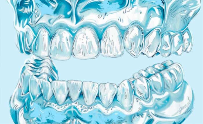 Как зубные протезы нового поколения