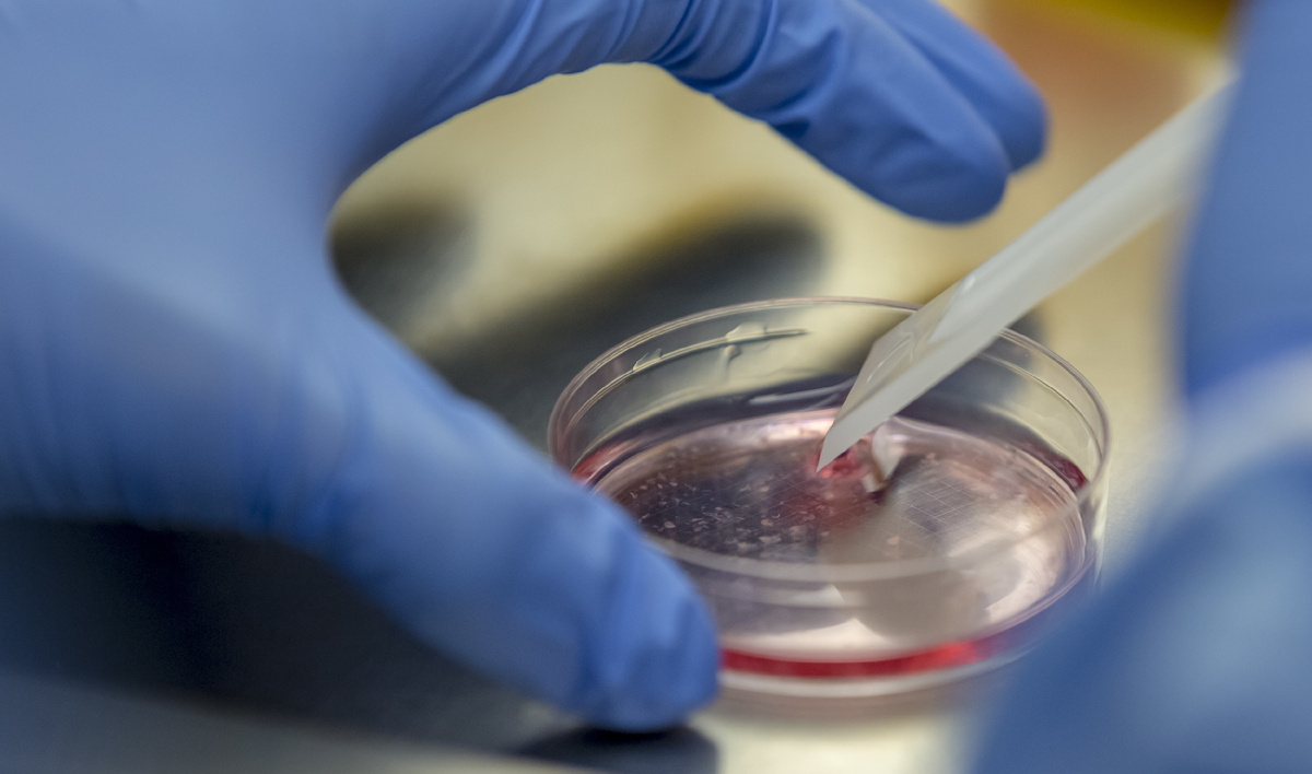 Органоид мозга в лабораторной чашке Петри с питательным раствором