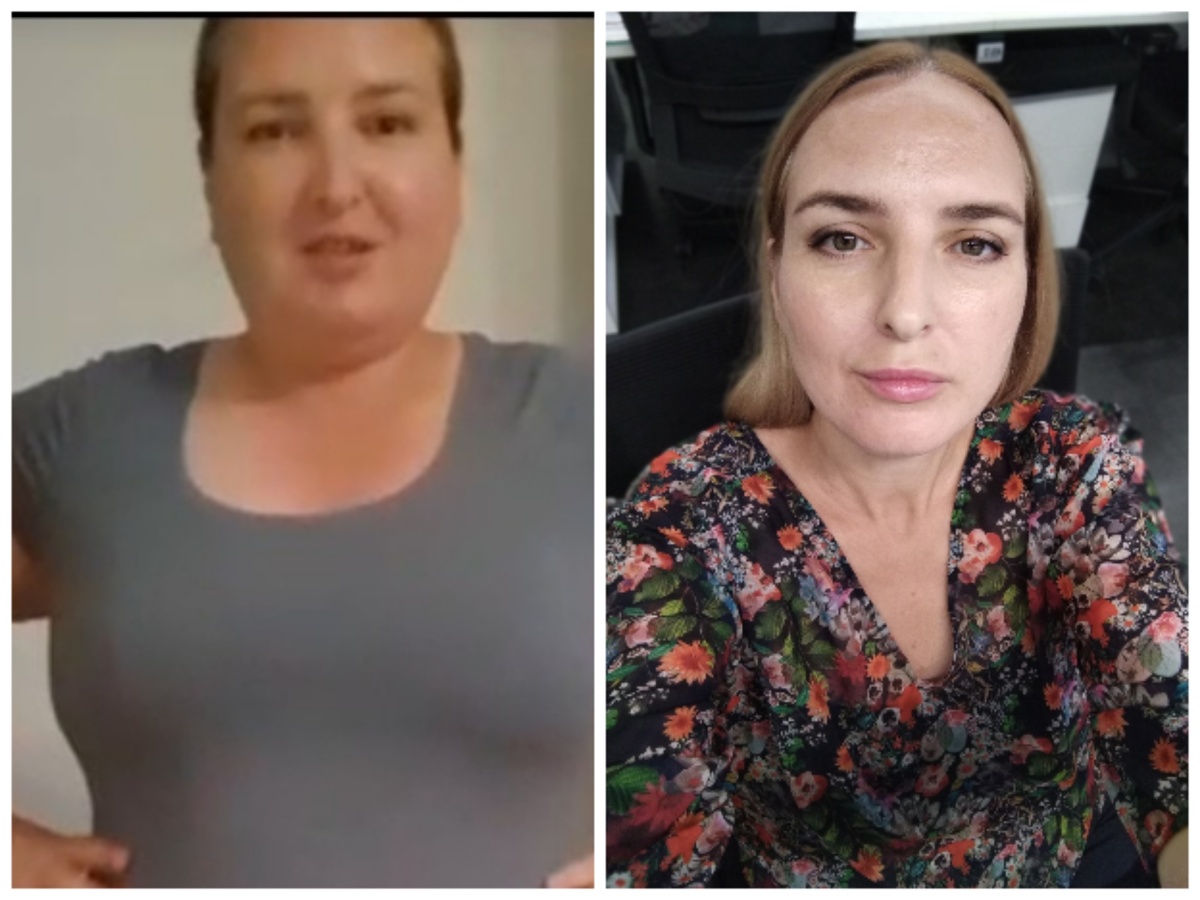 У меня в лицо все сразу откладывается первым делом. (( минус 37 кг. 