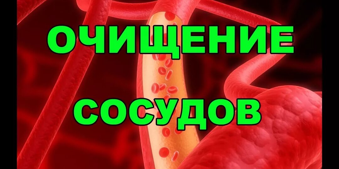 Очистка сосудов без таблеток и чудо-средств: что на самом деле работает — мнение врачей