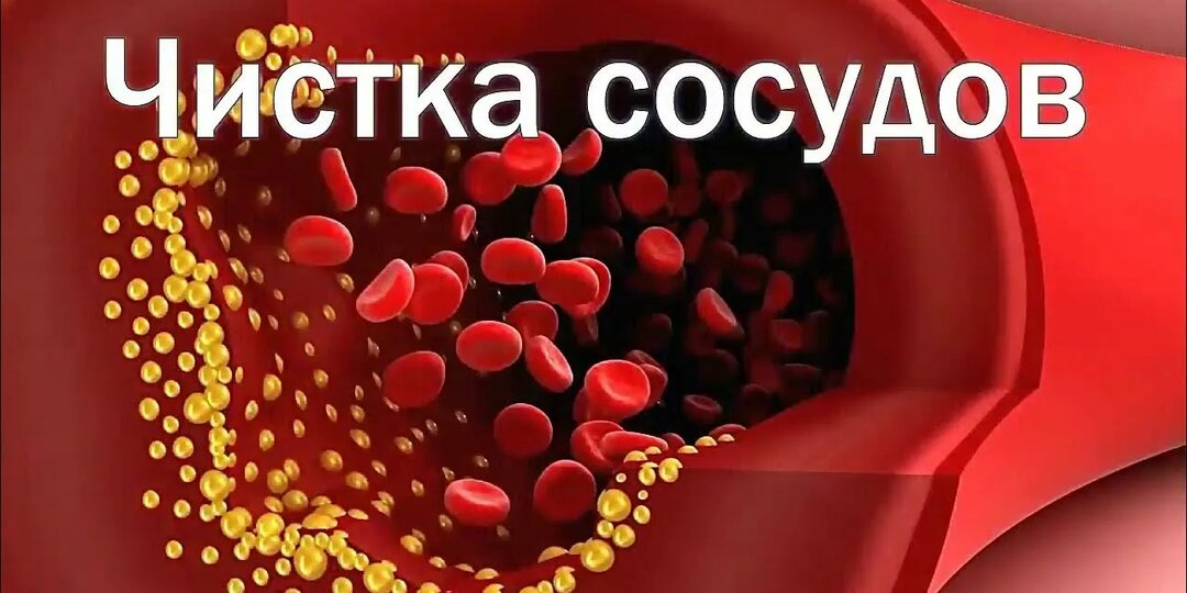Чистые сосуды — здоровое сердце: правда и мифы о «очищении», которое действительно работает
