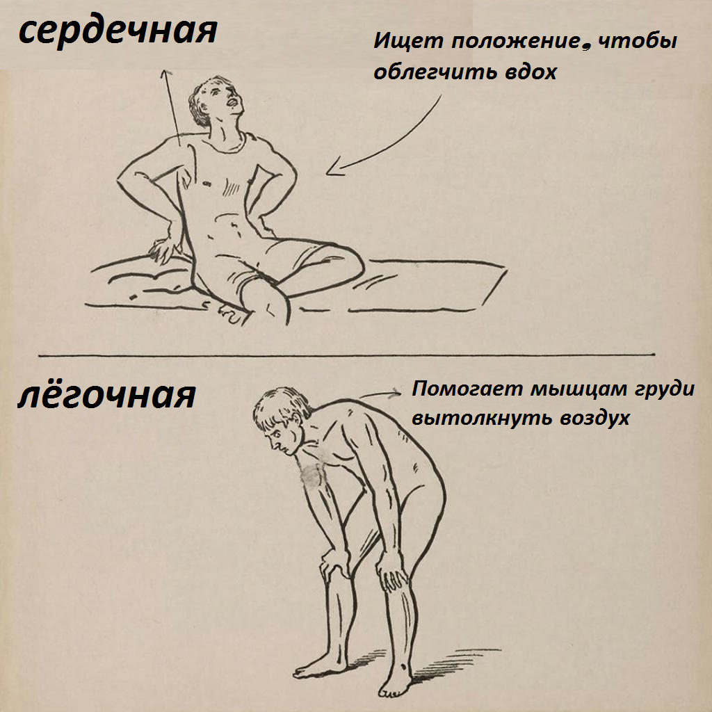 «Позы тела при одышке»