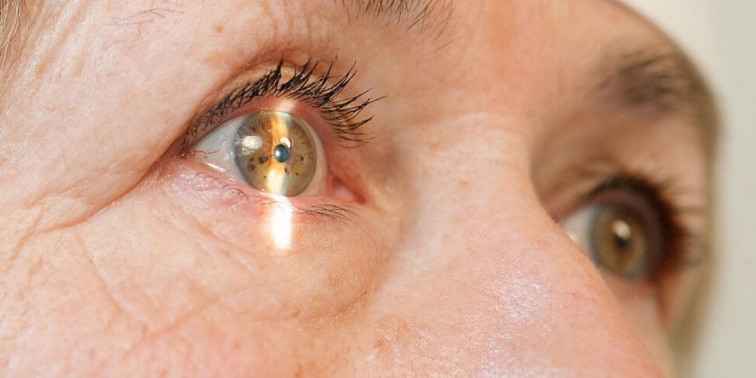 Катаракта не появляется из ниоткуда: какие болезни и состояния могут стать её причиной