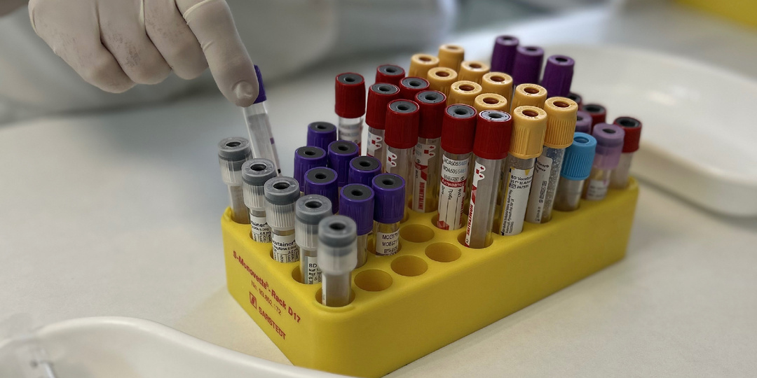 Зачем женщине знать свой гормональный фон, даже если ничего не болит