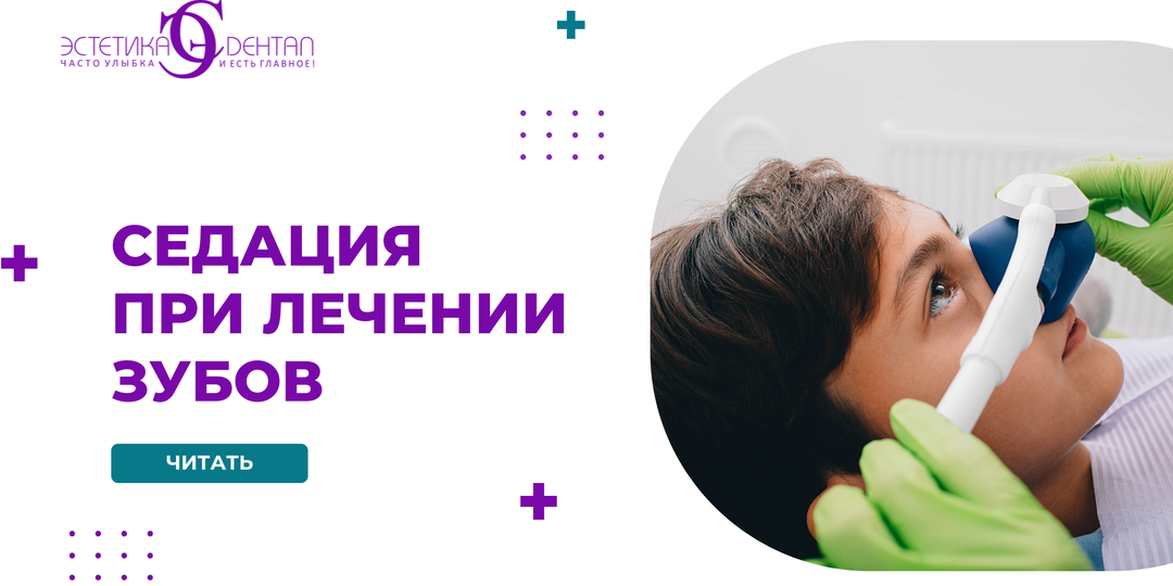 Седация при лечении зубов: подробное объяснение для пациентов