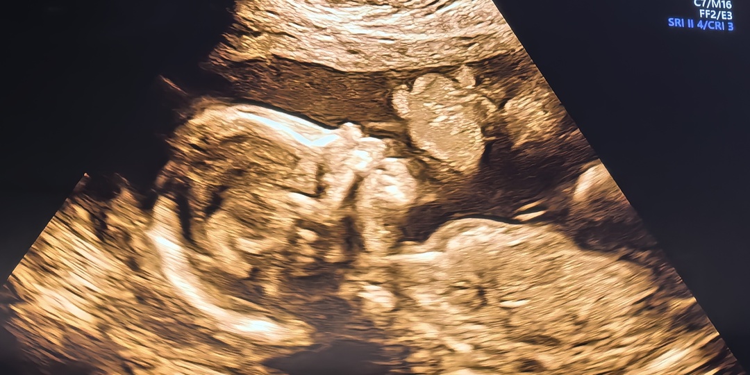 Дневник четвертой беременности. 21 недель. Пережили второй скрининг.