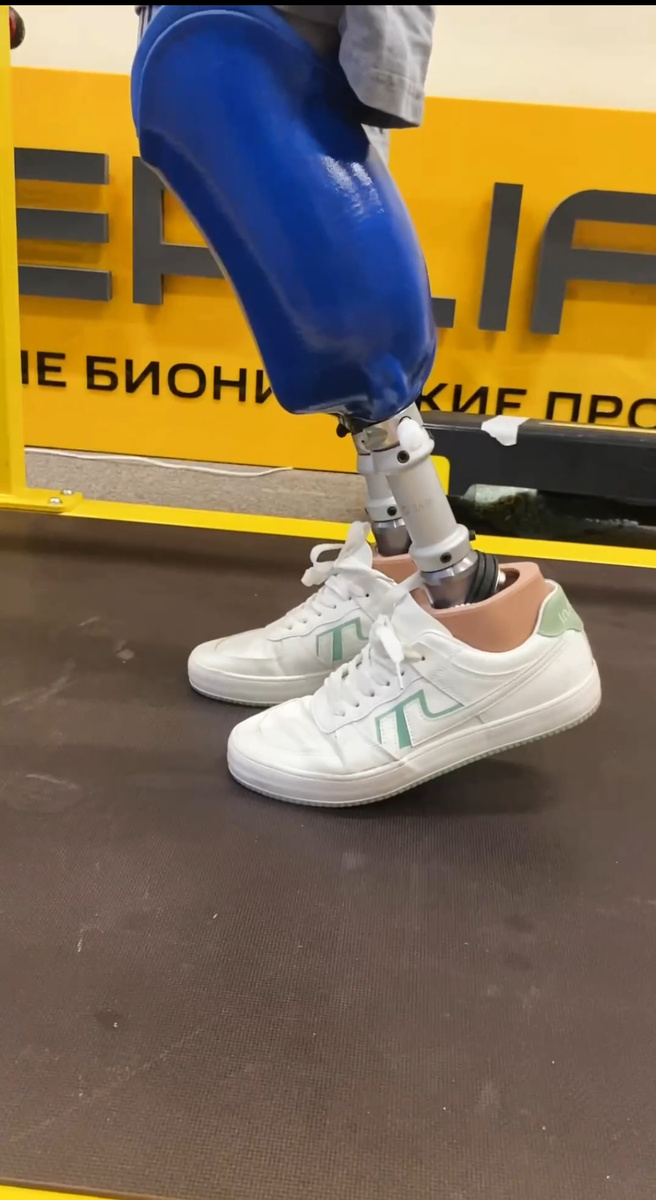 Неправильная схема сборки протеза ( без учета патологической анатомии )