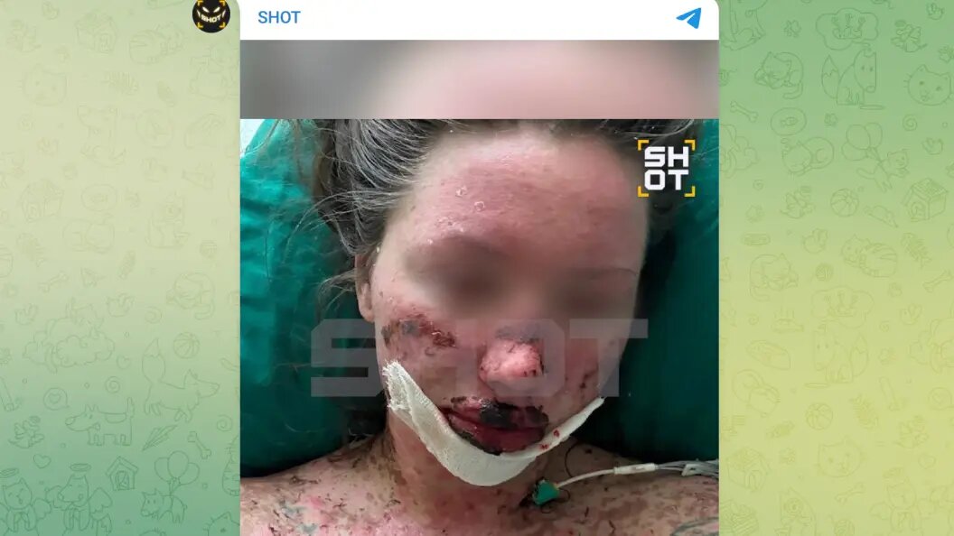    Telegram-канал SHOT