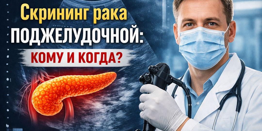 Скрининг рака поджелудочной железы: кому он действительно нужен и почему не всем?