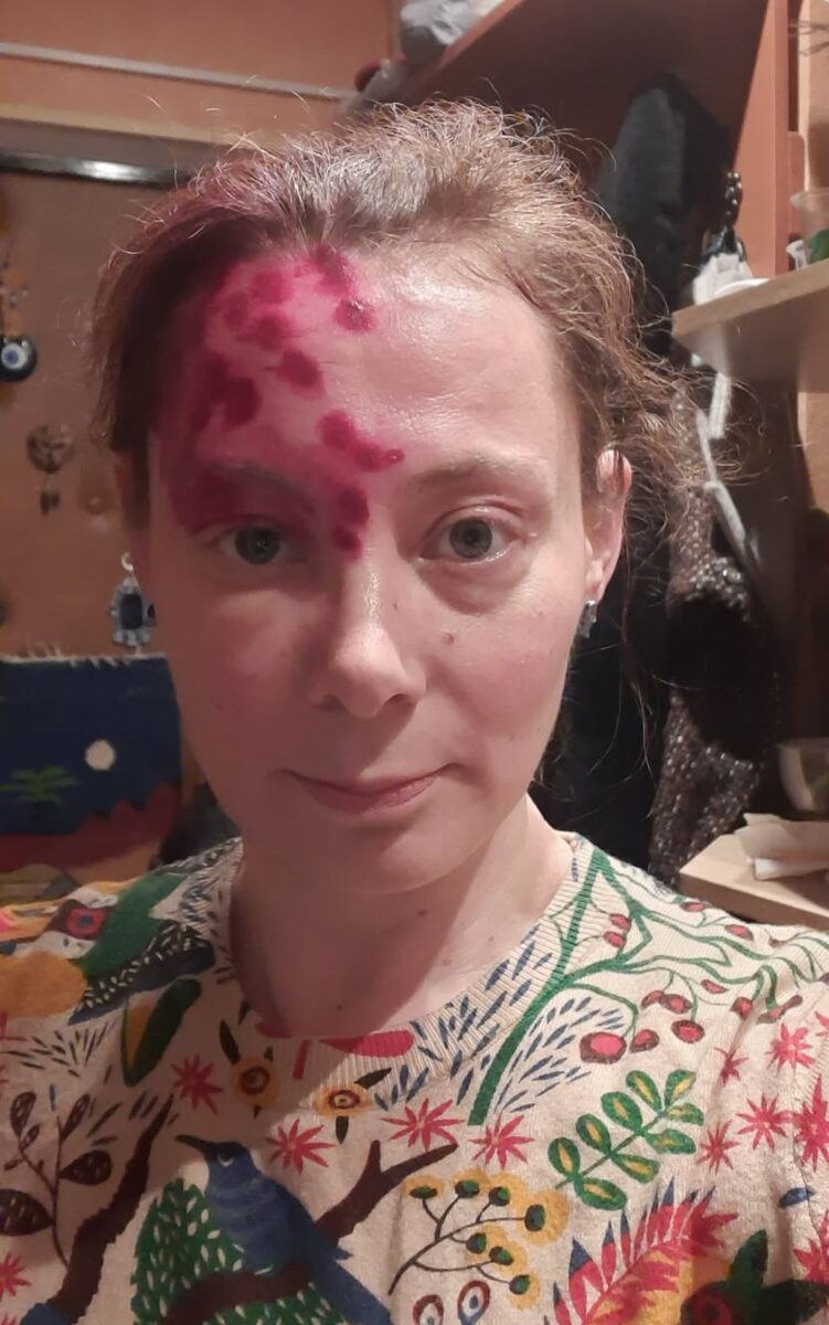 Когда перестаёшь шарахаться от зеркала, становится даже смешно