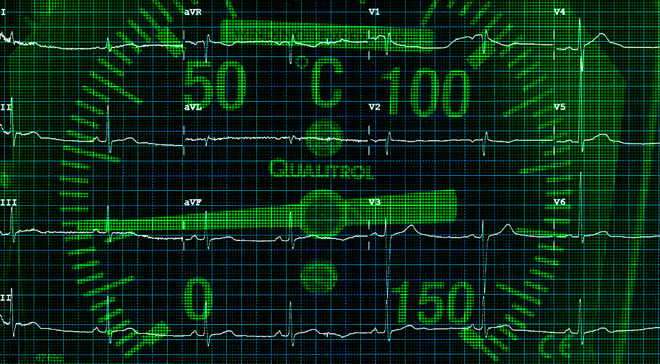   N + 1; PxHere / CC0; Peterhcharlton / Wikimedia Commons / CC-BY-4.0