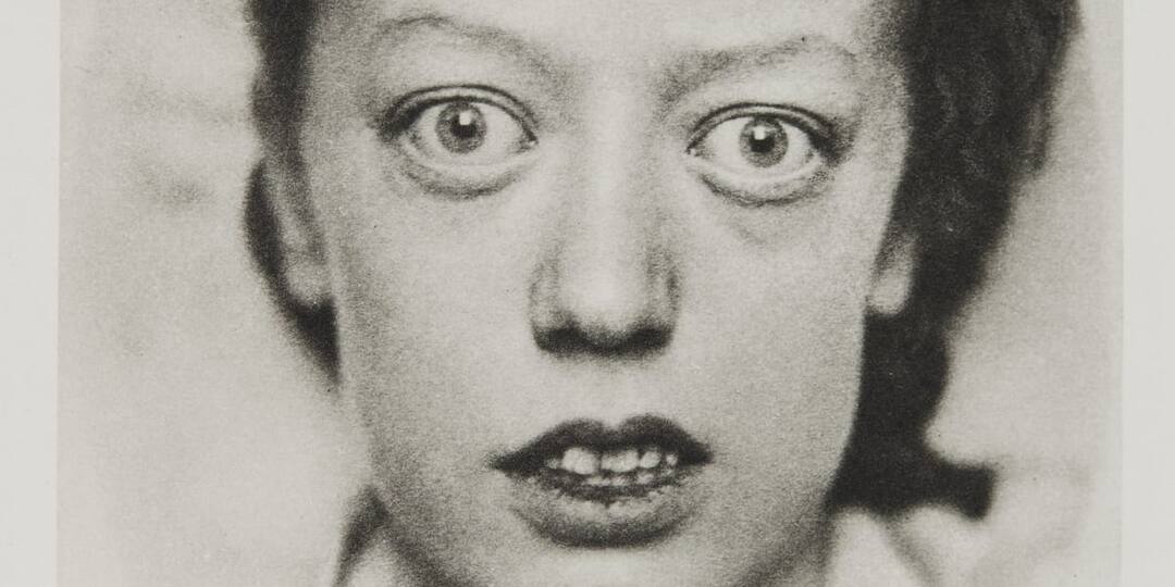 Гипертиреоз глазами пациента: причины, симптомы и как я лечусь