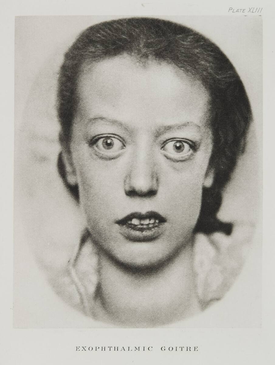 Ramsay, A Maitland, Шотландия, 1898 год. 