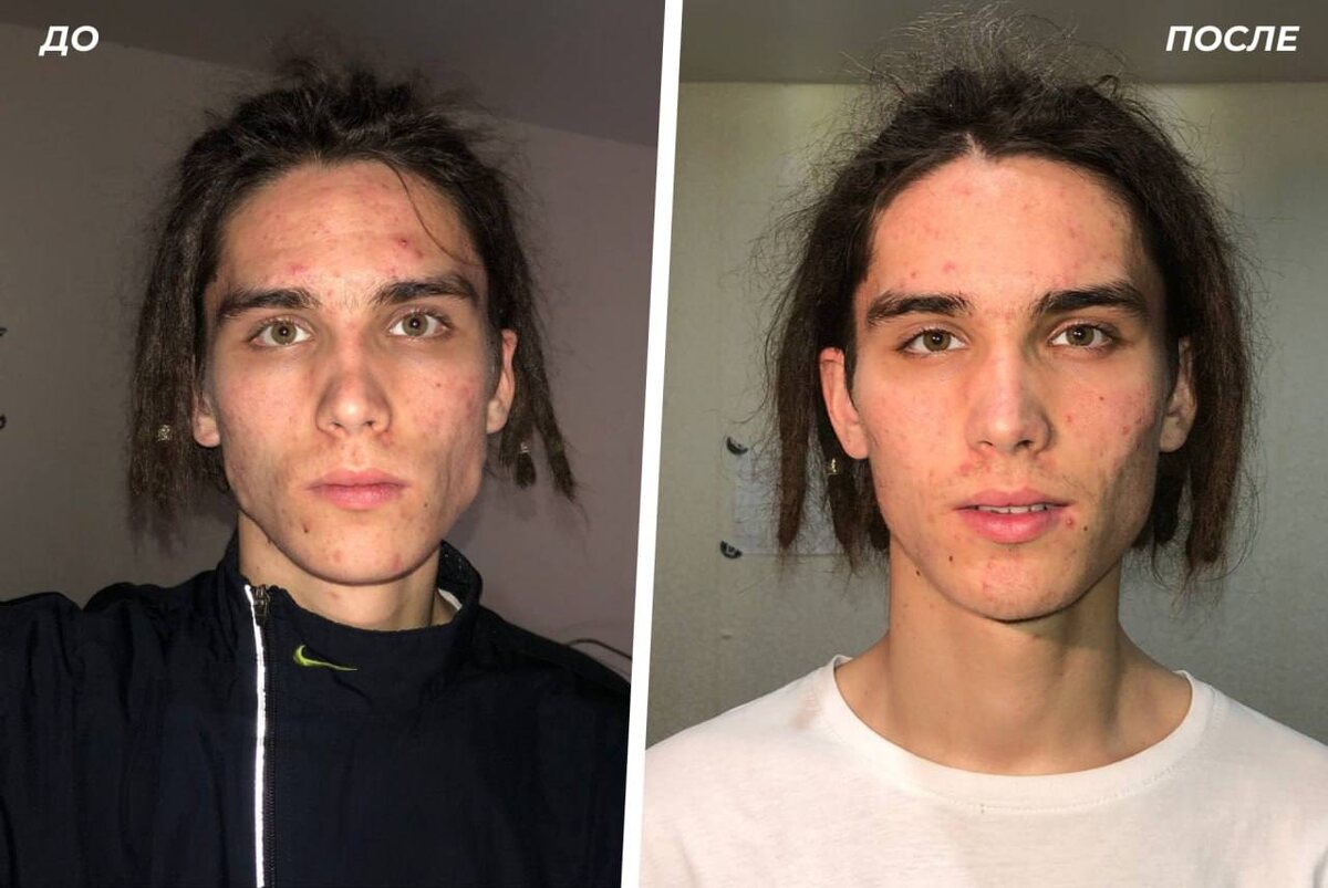 «До/после» 14 дней курса по методу снятия зажимов. Ну вы просто взгляните это же фантастическая разница!
Из запутанного, запуганного, зажатого тонкокожего моментальная трансформация за 2 недели, в развернутого, свободного, с разблокированным инстинктом сексуальности парня