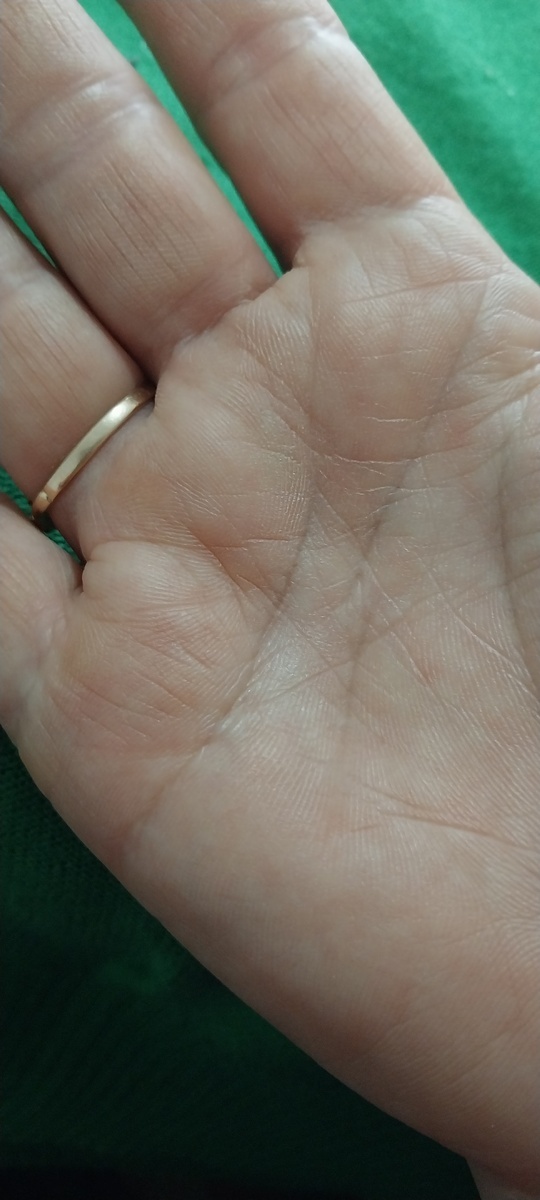 Фото рук женщины. Правая рука. 