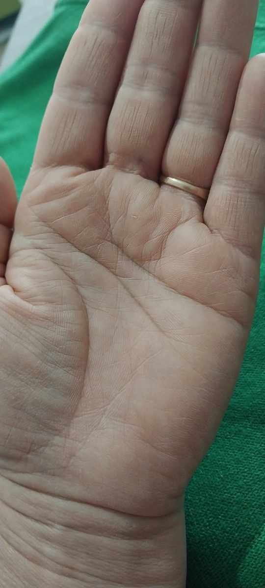 Фото левой руки. 