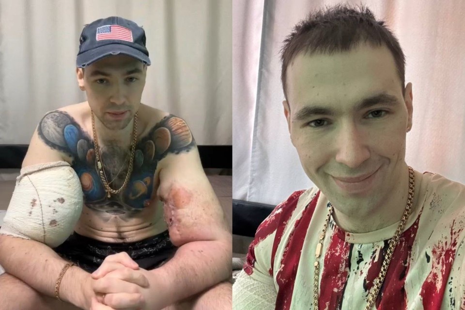    Терешин удалил вазелин из рук и вывел филлеры с лица. Фото: стоп-кадр видео Кирилла Терешина