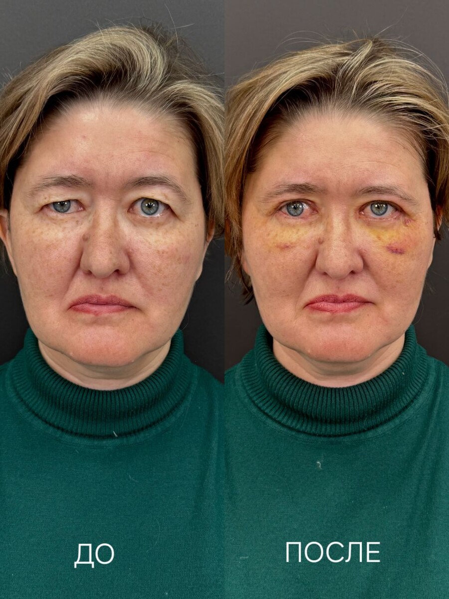 До и после операции 