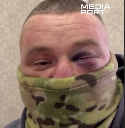    Накат внутривидового противостояния. В Харькове сотрудники ТЦК несколько раз избили ветерана ВСУ, украв у него деньги