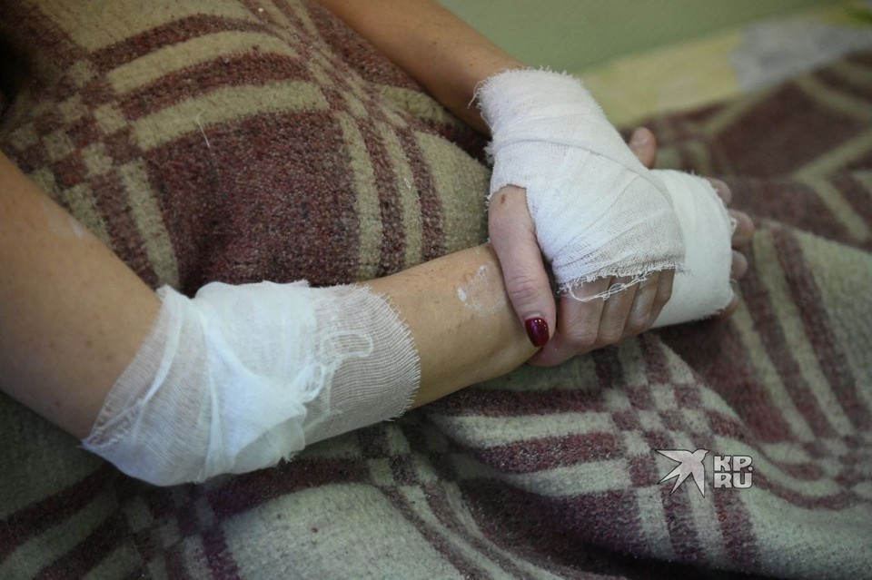    Девушка закрыла голову руками во время нападения, поэтому и их тоже обожгло Ольга ЮШКОВА