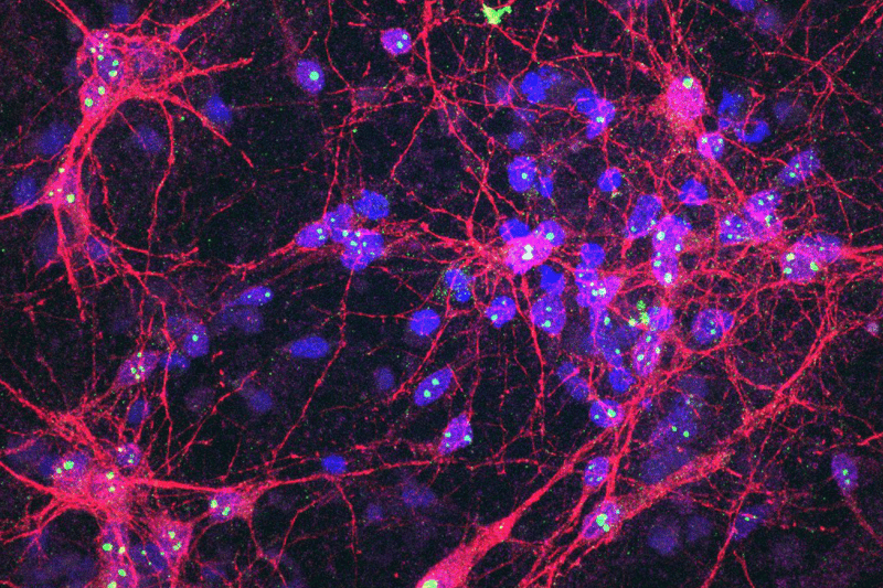    Развитие органоидного интеллекта стремительно прогрессирует и вызывает немало этических вопросов.